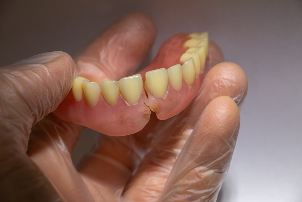 Broken removable denture with cast reinforcement. Upper full plastic prosthesis on hand in gloves