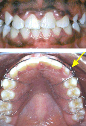 ortho-07-after