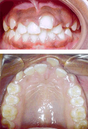 ortho-07-before