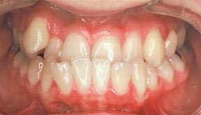 ortho_01_before