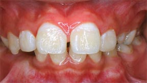 ortho_03_after