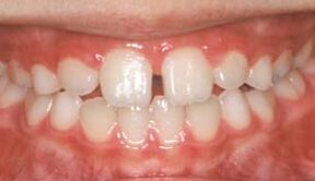 ortho_04_after