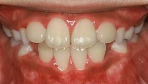 ortho_05_after