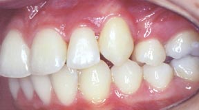 ortho_06_after