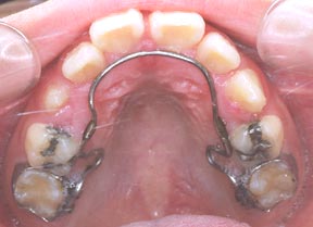 ortho_08_after