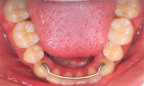 ortho_09_after