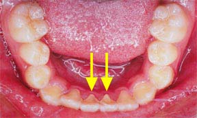 ortho_09_before