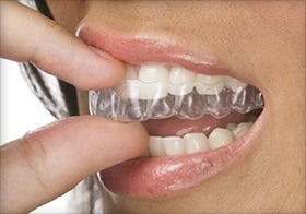 get straight teeth with invisible braces in Clovis and Fresno